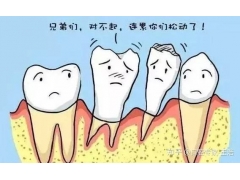【美莱口腔牙齿】牙周炎不可小觑