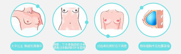 上海地区做自体脂肪隆胸需要多少钱
