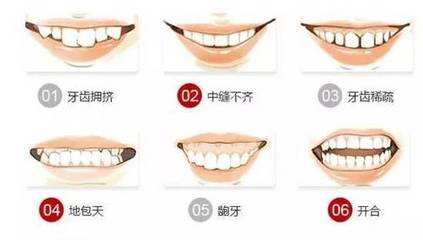 上海做正畸牙齿龅牙几岁比较好
