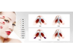 上海一些医院做鼻综合整