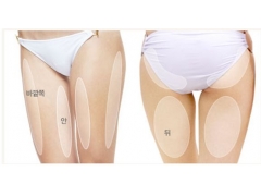 腿部吸脂手术美莱需要多少钱