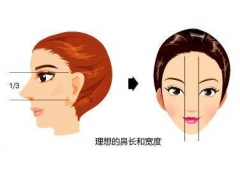 上海整形医院隆鼻美莱好不好