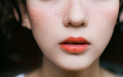 上海美莱激光祛斑肌肤会受到伤害吗