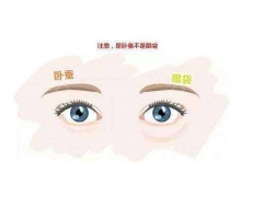 在上海做眼袋吸脂手术要多少钱