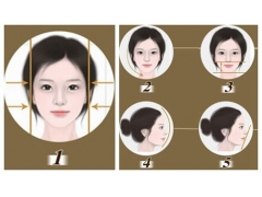 美莱介绍:微创改脸型的手术优点有哪些