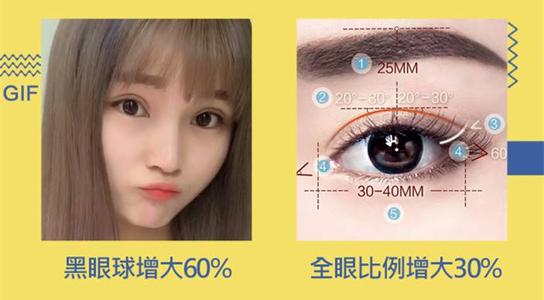 上海美莱做开眼角安全吗