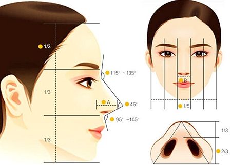 美莱做了假体隆鼻后还能取出假体吗