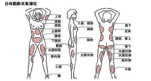 美莱做自体脂肪隆胸，一般都抽哪些部位