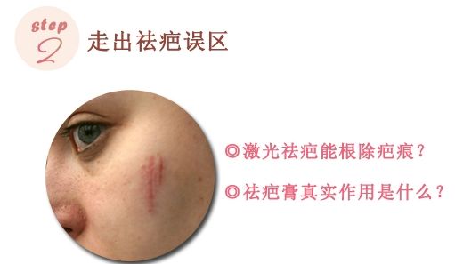 上海美容医院做激光祛疤手术好不好