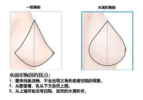<a href='/' target='_blank'><u>上海整形</u></a>医院做假体隆胸怎么做
