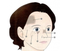 脸上有黄褐斑如何能彻底消除
