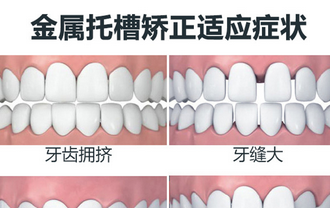 上海箍牙哪家医院好