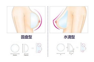 上海假体丰胸水滴好还是圆盘好