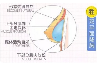 上海假体丰胸水滴好还是圆盘好