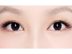 做韩式双眼皮整形手术需要多少钱