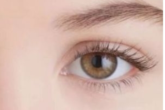 双眼皮怎么预防增生，双眼皮增生了怎么办