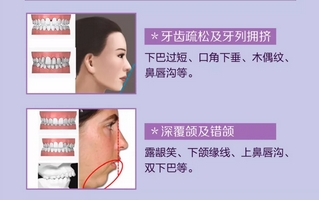 上海美莱微笑体验官招募开启