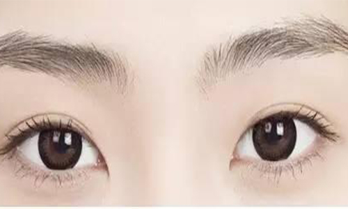 上海双眼皮手术有哪几种，哪种好