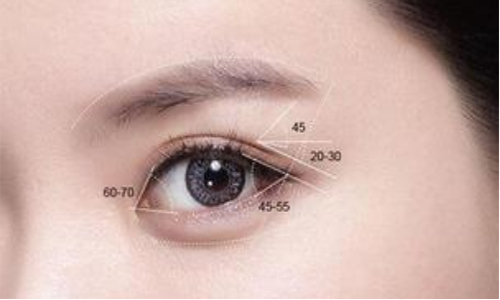 双眼皮整形手术都有哪几种类型