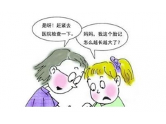 激光去除胎记会不会很疼