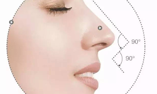 假体隆鼻整形手术后应该怎么护理