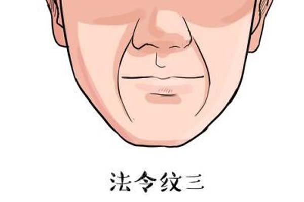 上海注射玻尿酸去除嘴角纹价格是多少钱