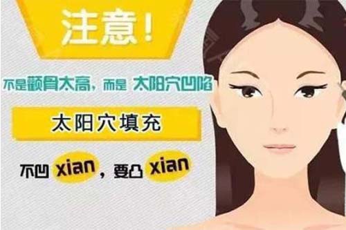 太阳穴凹陷很严重很难看怎么办