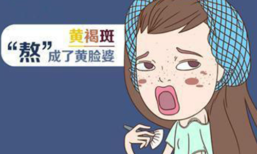 上海治疗黄褐斑哪家医院好