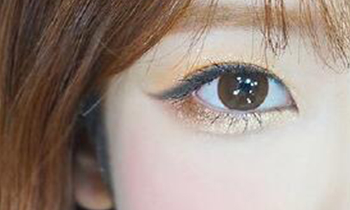 韩式三点双眼皮手术优势有哪些