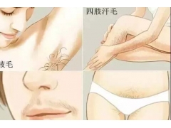 激光脱毛怎么样,安全吗