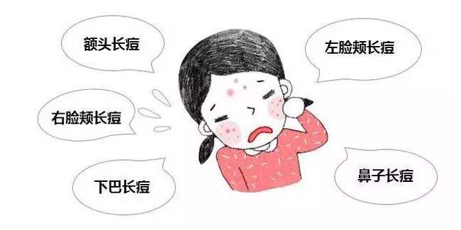 脸上长了很多痘痘怎么办