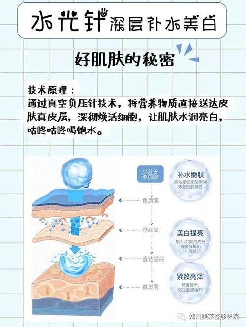 上海注射水光补水真的好吗