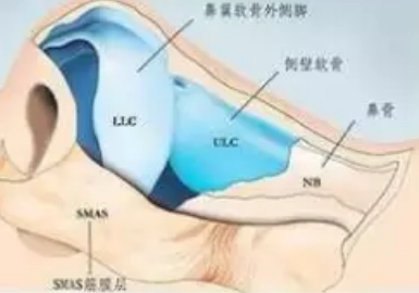 鼻整形后能捏鼻子吗,容易被看出来吗