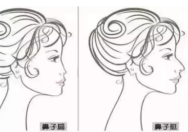 鼻整形后能捏鼻子吗,容易被看出来吗
