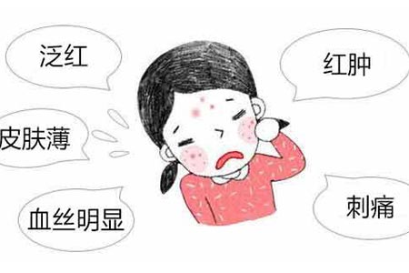 彩光去除红血丝好吗