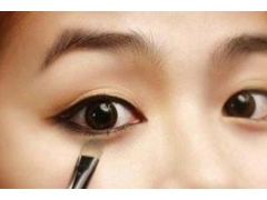 割双眼皮会不会有什么后遗症