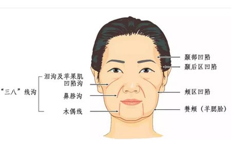 自体脂肪填充合适多少岁合适，面部填充怎么更自然