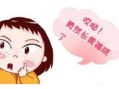 激光去除黄褐斑价格贵不贵,多少钱