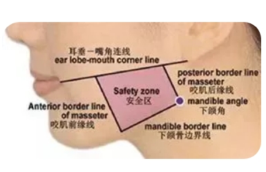 为什么有的人注射瘦脸没