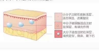 玻尿酸有其他影响吗？玻尿酸有依赖性吗？