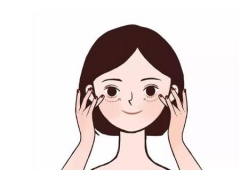 什么是埋线双眼皮，有什么优点
