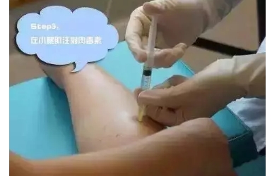 什么是瘦腿针？怎么注射瘦腿针？