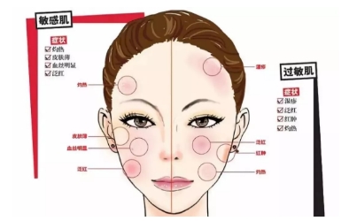 敏感肌是怎样形成的？变成敏感肌了怎么办？