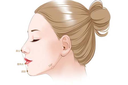 假体隆鼻整形手术有透光的风险吗