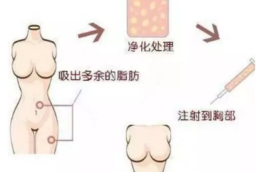 天生胸位低怎么办？