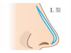 假体隆鼻整形术后鼻子会不会留疤