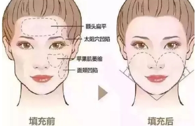 面部整形6大原则助你科学设计美