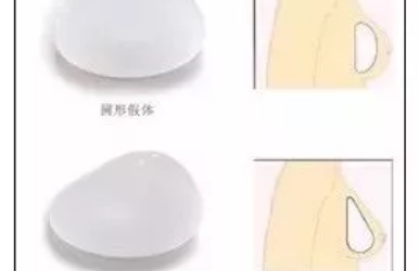 美莱丰胸技术是如何打造自然坚挺的酥胸呢?