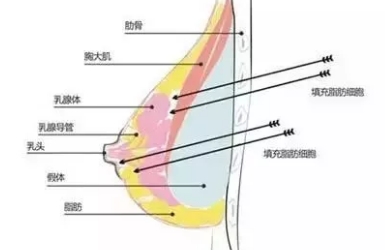 美莱丰胸技术是如何打造自然坚挺的酥胸呢？