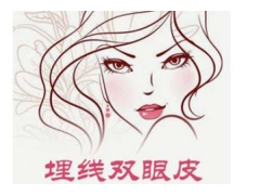 埋线双眼皮整形手术到底怎么样